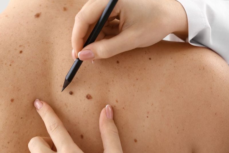 Warts removal preview logo slide
